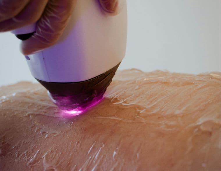 Епіляція та депіляція